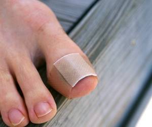 Болит ноготь на большом пальце ноги: при нажатии, что делать