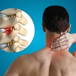 Головные боли при остеохондрозе шейного отдела: болит голова