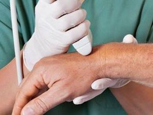Растяжение связок кисти руки: лечение в домашних условиях, симптомы
