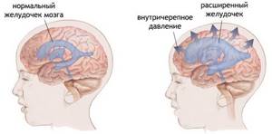 Болит правая часть головы: половина, пульсирующая боль, причины