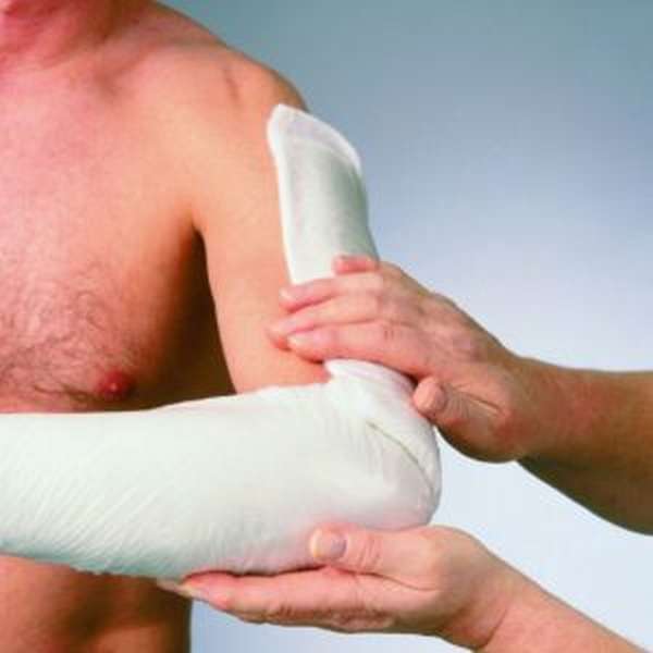 Перелом проксимального отдела плечевой кости: конца