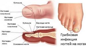 Аллергия на пальцах рук и пузырьки: лечение, чем лечить