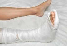Как долго болит нога после перелома лодыжки: сколько, когда можно